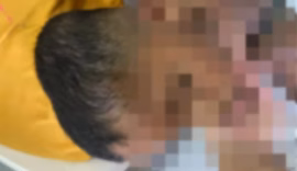 MPAL investiga denúncia de agressões contra criança com autismo em Arapiraca