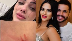 Justiça condena influencer Babal Guimarães por violência doméstica