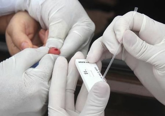 Alagoas confirma mais 370 novos casos de Covid-19