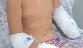 Criança de 10 anos  perde parte do braço após grave colisão entre ambulância e ônibus em Maribondo