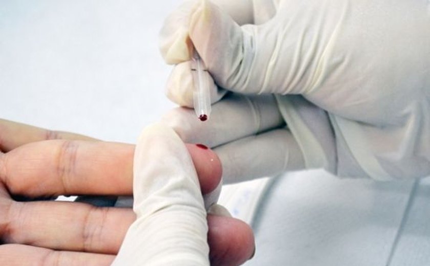 Helvio Auto fará testes para detectar HIV e sífilis abertos à população