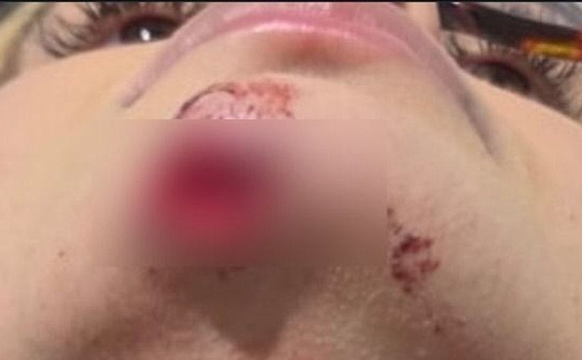 Influenciadora denuncia ex por agressão e afirma ter sido arrastada por carro em Maceió