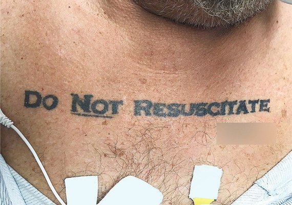 Homem com tatuagem 'não ressuscite' chega inconsciente a hospital e médicos ficam em dúvida