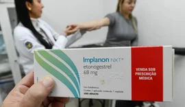 Implante contraceptivo deve ser ofertado por planos a partir desta segunda-feira (1)