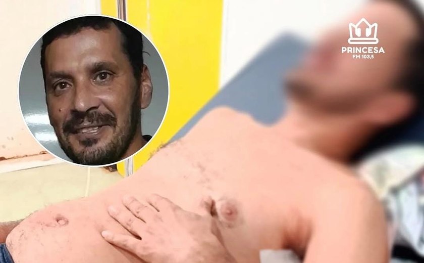 Nando do Reggae passa por cirurgia após ser ferido durante discussão política em Viçosa