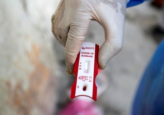 Alagoas registra nesta quarta 802 novos casos de Covid-19 e média de uma morte por hora