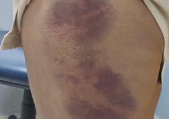 Eletricista agride e ameaça arrancar dedos da esposa com alicate e é autuado em flagrante por violência doméstica