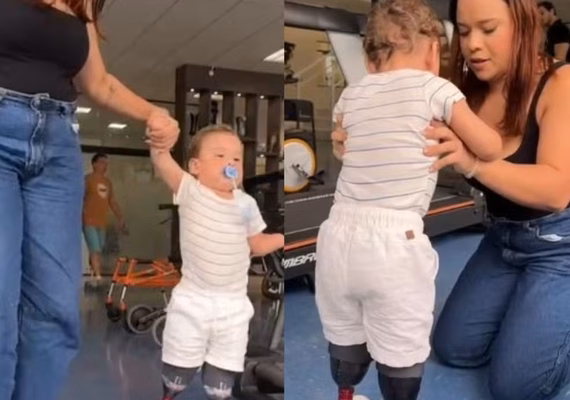 Noah Gabriel, de 1 ano, dá primeiros passos com próteses após perder mãos e pés