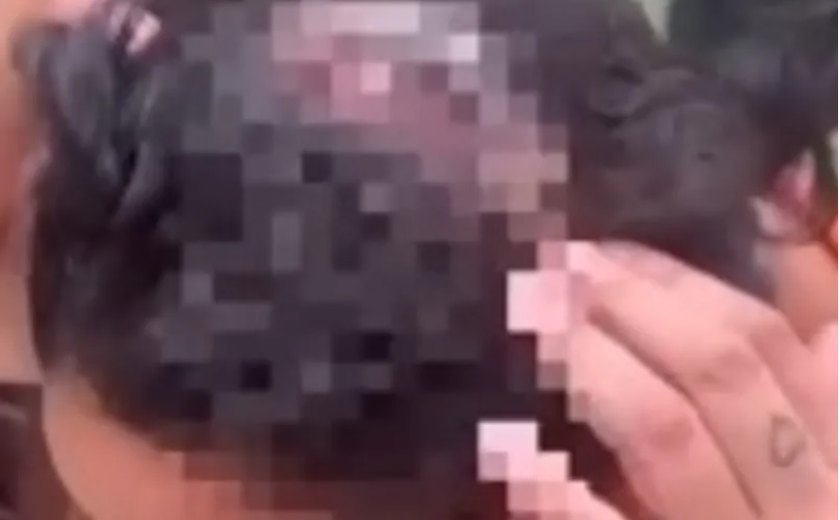 Homem ataca ex com golpes de foice na cabeça em Junqueiro