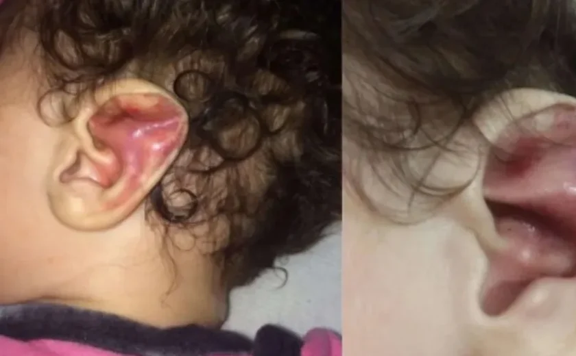 Mãe é presa após  torturar e fraturar costelas de filha de seis meses em 2021