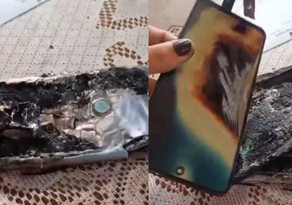 Celular explode no bolso e provoca queimaduras de 3º grau na perna de homem no interior de SP