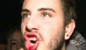 Jovem agredido por Justin Bieber pode processar cantor, mas diz: ‘Sigo sendo fã’