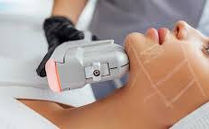 Tecnologia HIFU ganha destaque em tratamentos estéticos em Maceió