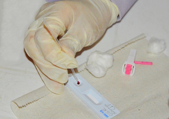 Sesau orienta sobre prevenção ao HIV; Alagoas já registrou 574 novos casos este ano