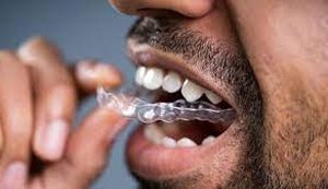 Bruxismo: Hábito de ranger os dentes pode causar vários prejuízos, mas há tratamento