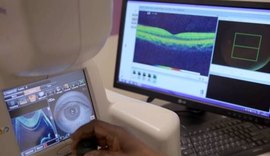 Inteligência artificial detecta risco de doença ocular melhor do que médicos