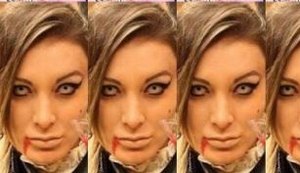 Andressa Urach posta novo antes e depois e choca internautas