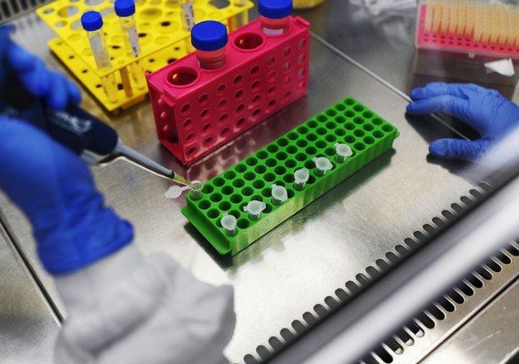 Número de mortes pelo Covid-19 no Brasil é de 159; MS diz que Alagoas segue com 17 casos