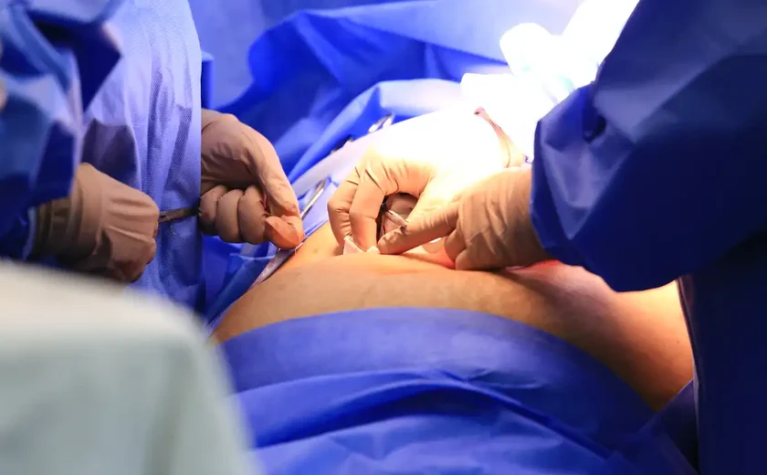Cinco estados podem zerar fila de cirurgias no SUS