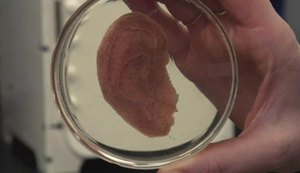 Cientistas usam maçã para criar tecido humano para transplante