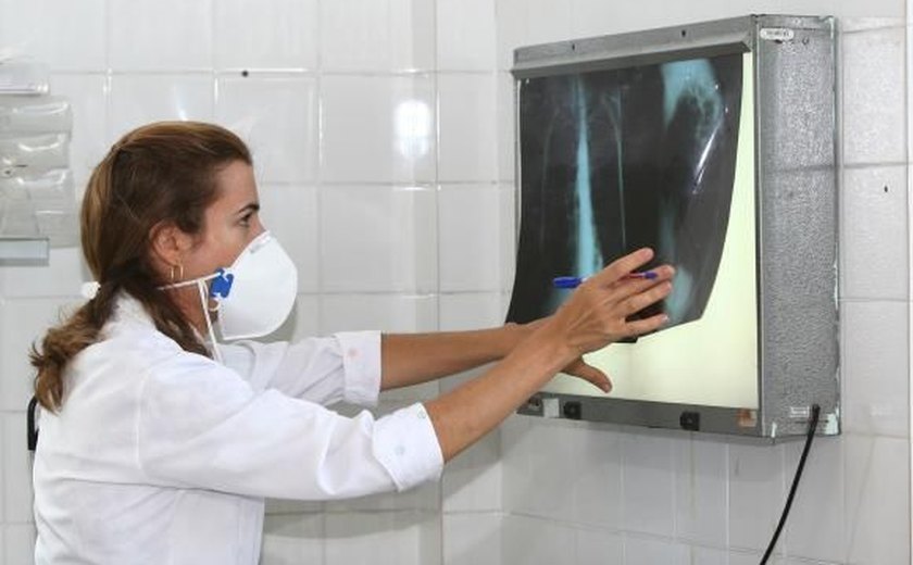 Brasil se aproxima de padrão positivo de combate à tuberculose, mostra relatório