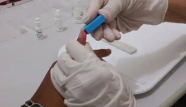 Maceió acima da média nacional em casos positivos de HIV