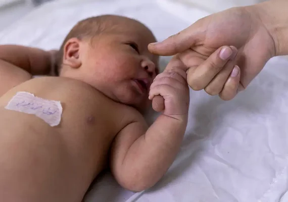 Teste do olhinho deve ser repetido três vezes ao ano até os 3 anos