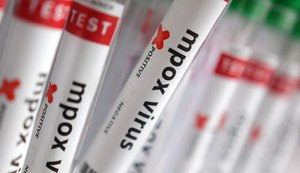 Região Norte do Brasil registra casos de mpox