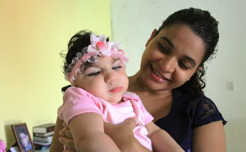 Crianças com microcefalia em Alagoas terão atendimentos médicos garantidos