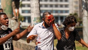 Dois homens atingidos pela PM com balas de borracha nos olhos perdem parte da visão