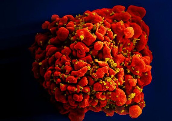 OMS alerta para alta nos casos de resistência do vírus HIV