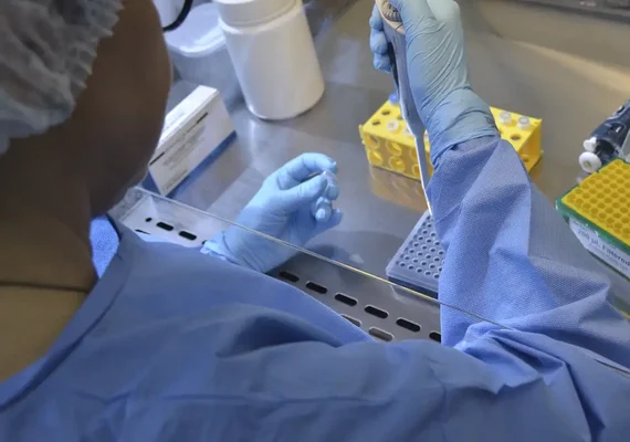 Brasil tem 17 casos confirmados de intoxicação por metanol
