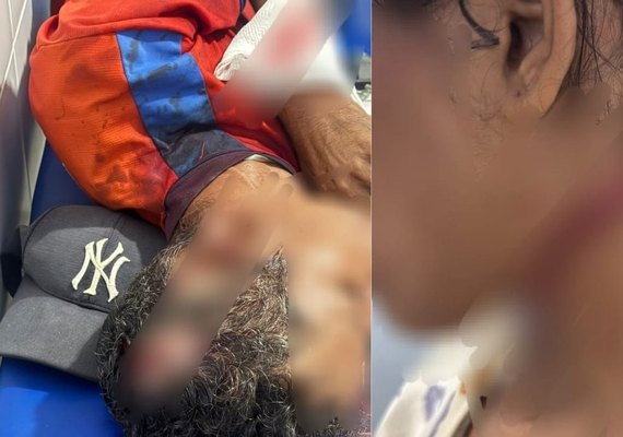 Homem é preso suspeito de tentar matar companheira e sogro em Paripueira