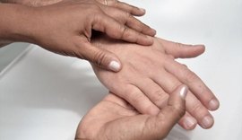 Sesau promove ação de conscientização contra a hanseníase no domingo (20)