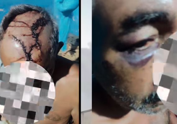 Polícia Civil prende autores de tentativa de latrocínio contra idoso de 60 anos em Coruripe