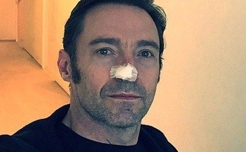 Hugh Jackman é submetido a novo tratamento contra câncer de pele