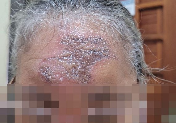 Após receberem ''óleo da graça'' durante missa, fiéis procuram paróquia com ferimentos na testa