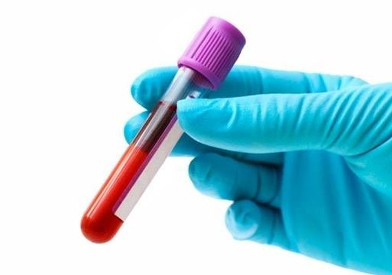 Casos de hepatite A dobram entre homens de 20 a 39 anos no país