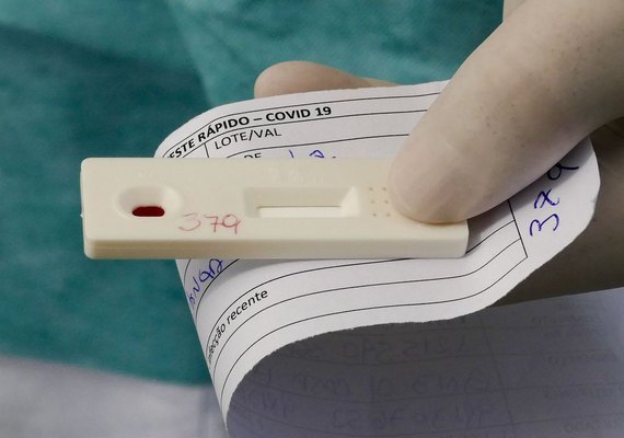 Alagoas registra 572 novos casos de Covid-19 e mais cinco mortes nesta quinta-feira (3)