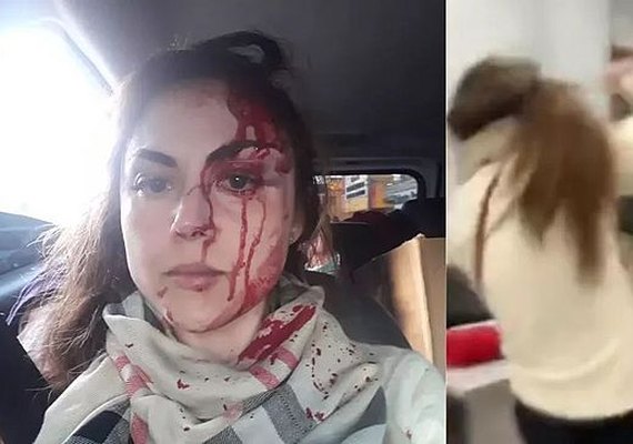 Agressor de procuradora foi afastado do cargo e teve salário cortado