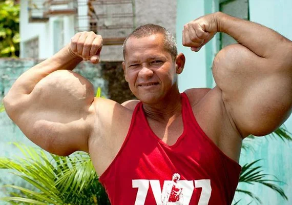 Morre Arlindo Anomalia, conhecido como Popeye Brasileiro, aos 55 anos