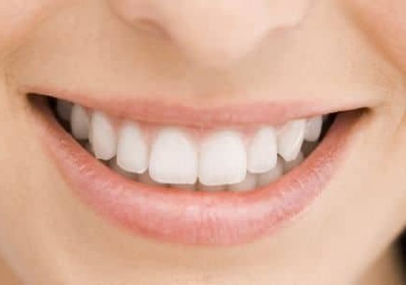 Cremes dentais não resolvem sozinhos erosão dental e hipersensibilidade