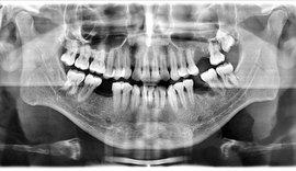 Perícia legal identifica corpo de mototaxista