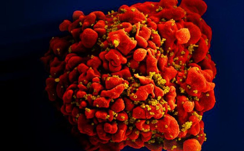 OMS alerta para alta nos casos de resistência do vírus HIV
