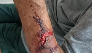 Presa suspeita de assaltar e agredir idoso com capacete em Delmiro Gouveia