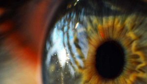 Busca por transplante de córnea cresce no Brasil