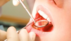 Apenas 37% dos homens frequentam o dentista em Alagoas