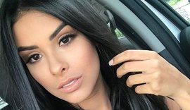 Vencedora do 'BBB 16', Munik Nunes passa por cirurgia em Fortaleza