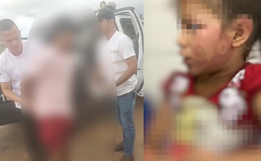 Pai é preso em Taquarana por agredir filha de 6 anos com sandália