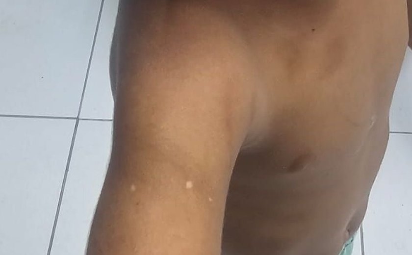 Padrasto e mãe são presos em flagrante por agressão a criança de 3 anos em Maceió
